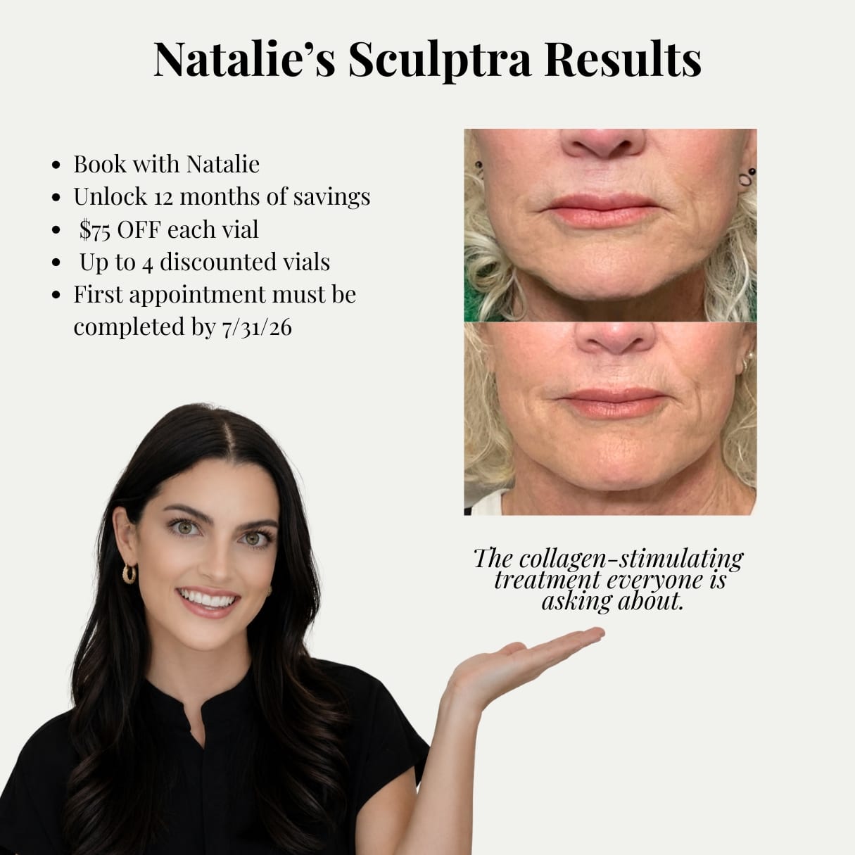 Natalie Sculptra Promo